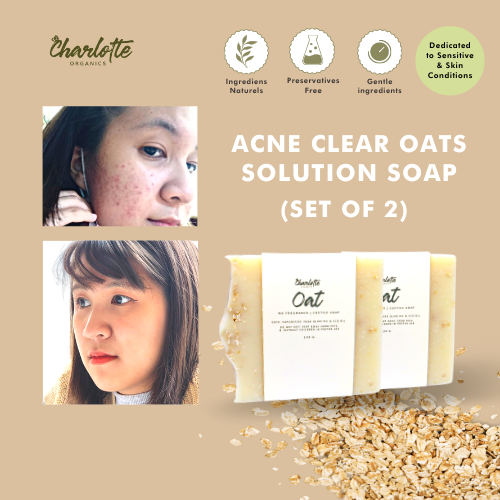(Set of 2) Charlotte Organics Acne Clear Oats Solution Soap My Store