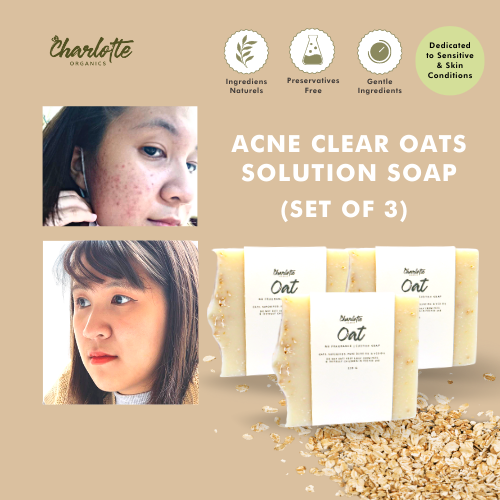 Pimple best sale clear soap